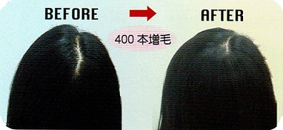 増毛ビフォーアフター